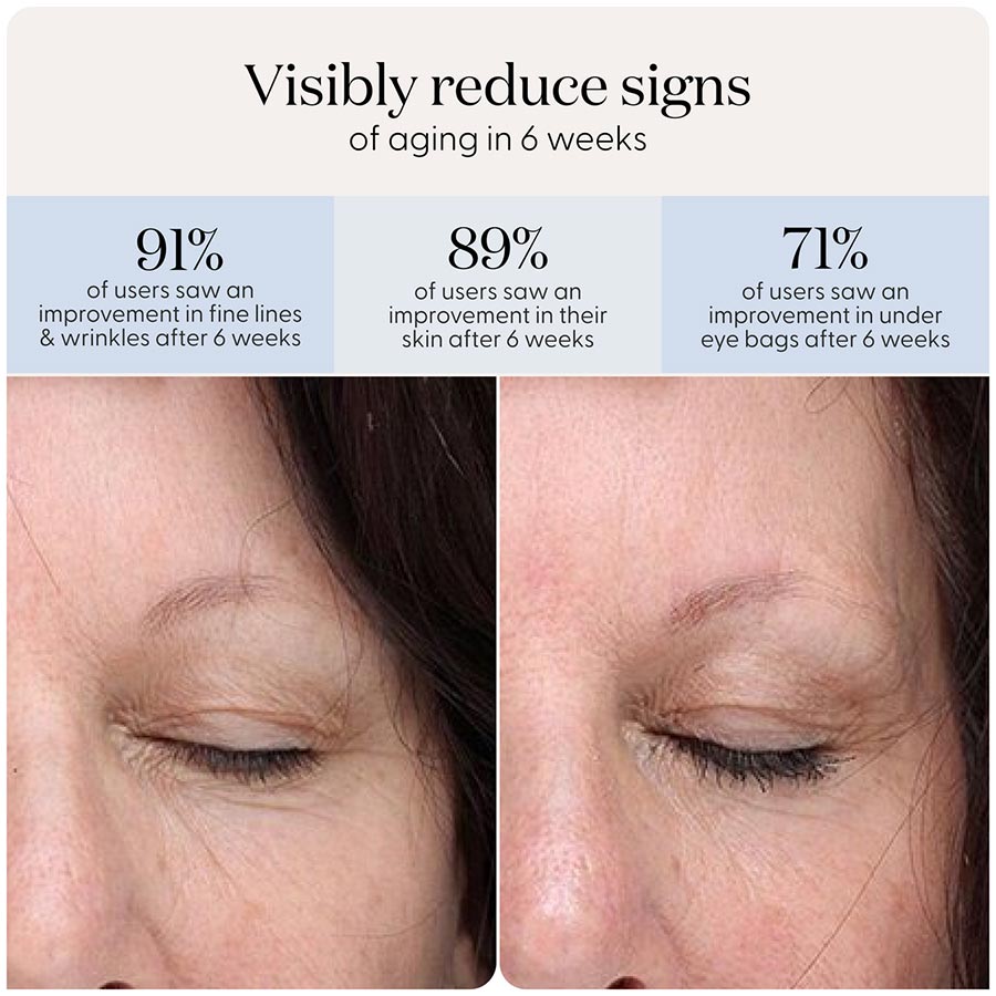 Red light therapy LED eye patches + hydrocolloids